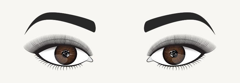 Visual example of the ideal eyelash style for deep-set eyes, featuring longer lash extensions placed at the centre to open up the eye.