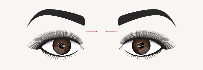 Illustration of the best eyelash style for close-set eyes, showing longer lash extensions at the outer corners to create the illusion of wider-set eyes.
