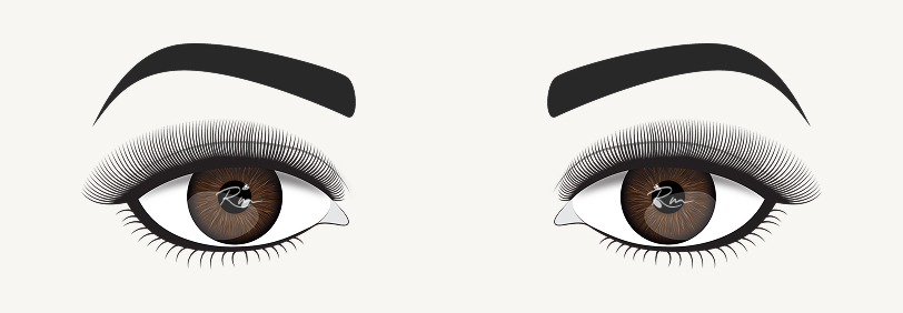 Visual guide for styling eyelash extensions on downturned eyes using a cat-eye effect with longer lashes at the outer corners.